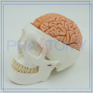 PNT-1150 Customized Human Skull Modell für den medizinischen Gebrauch